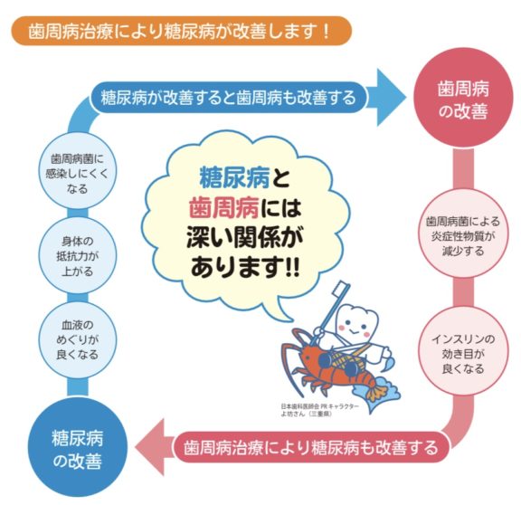 歯周病と糖尿病 四日市の歯医者 岩崎歯科 インプラント・入れ歯・矯正歯科・歯周病・予防歯科